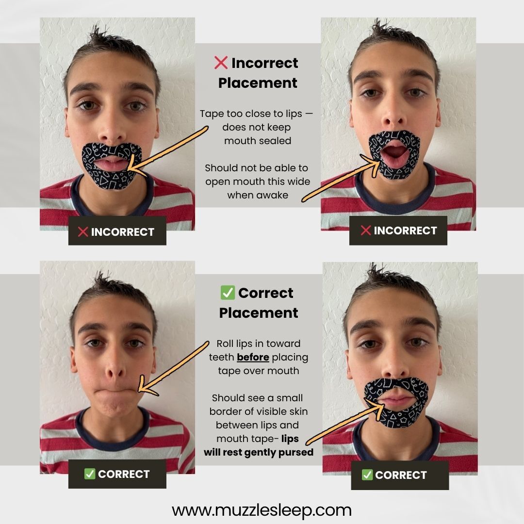Muzzle® Mouth Tape For Kids (Extra Sensitive)