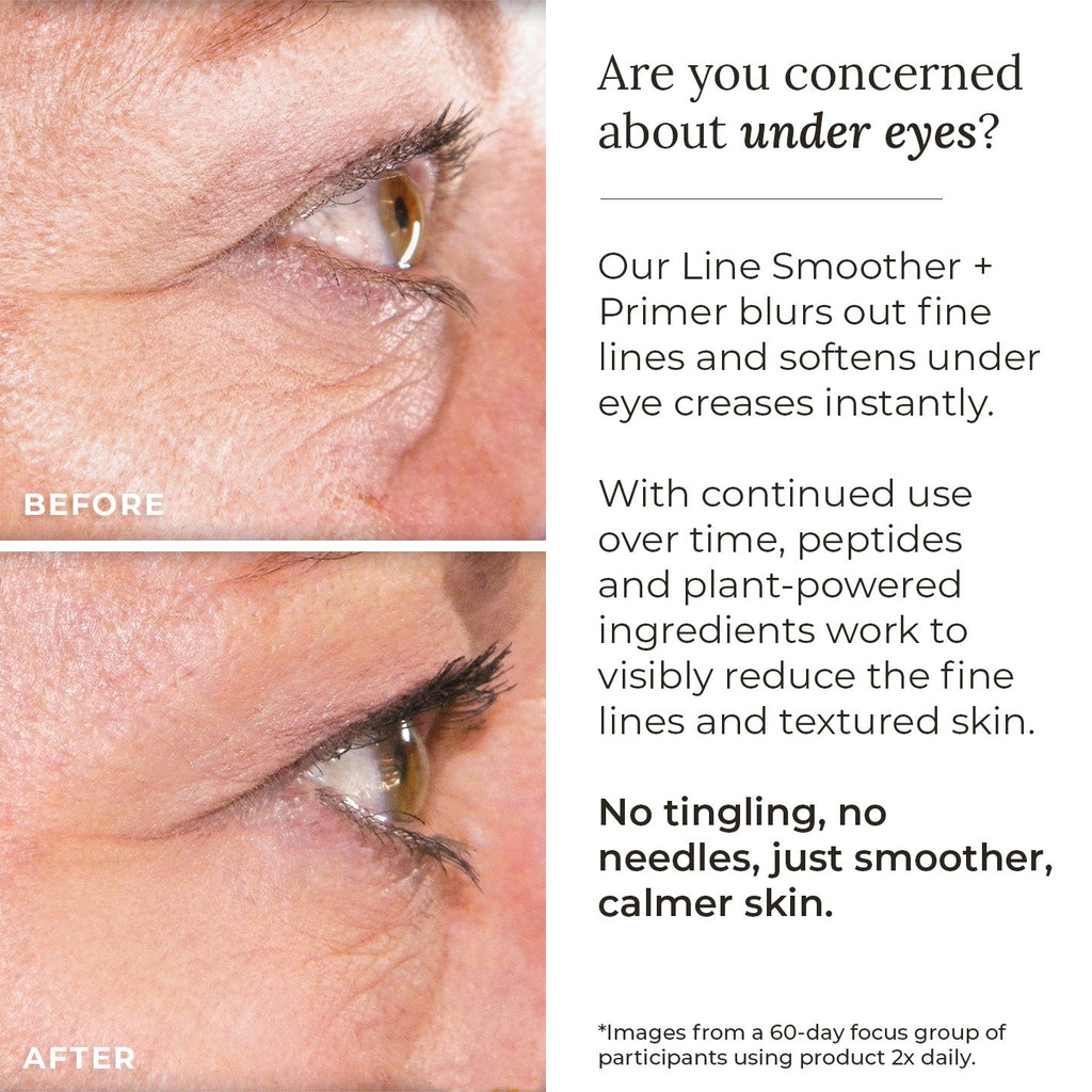 Line Smoother + Primer with Neodermyl®
